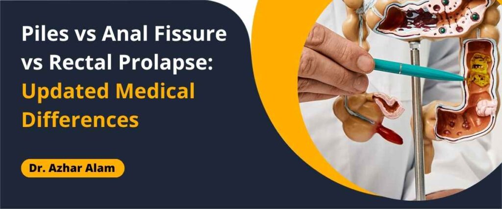 Piles vs AnaFissure vs Rectal Prolapse