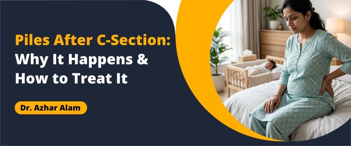 Piles After C-Section treatment guidance for postpartum mother
