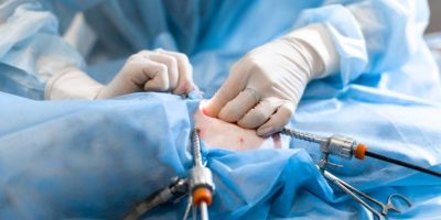 Fissure Doctor in Kolkata